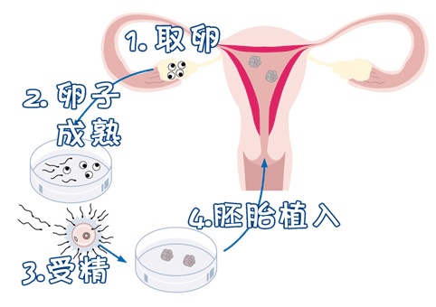 周顾问